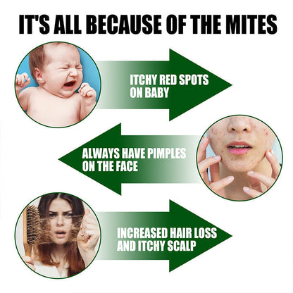 🎉Summer Special 50% off🎉Powerful Mite Remover Spray - Deep Clean, Protect Health!
